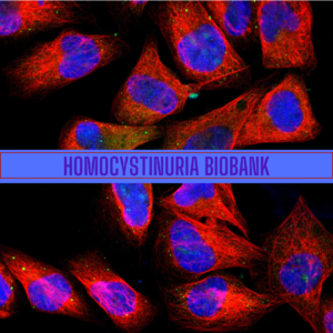 Homocystina biobank.