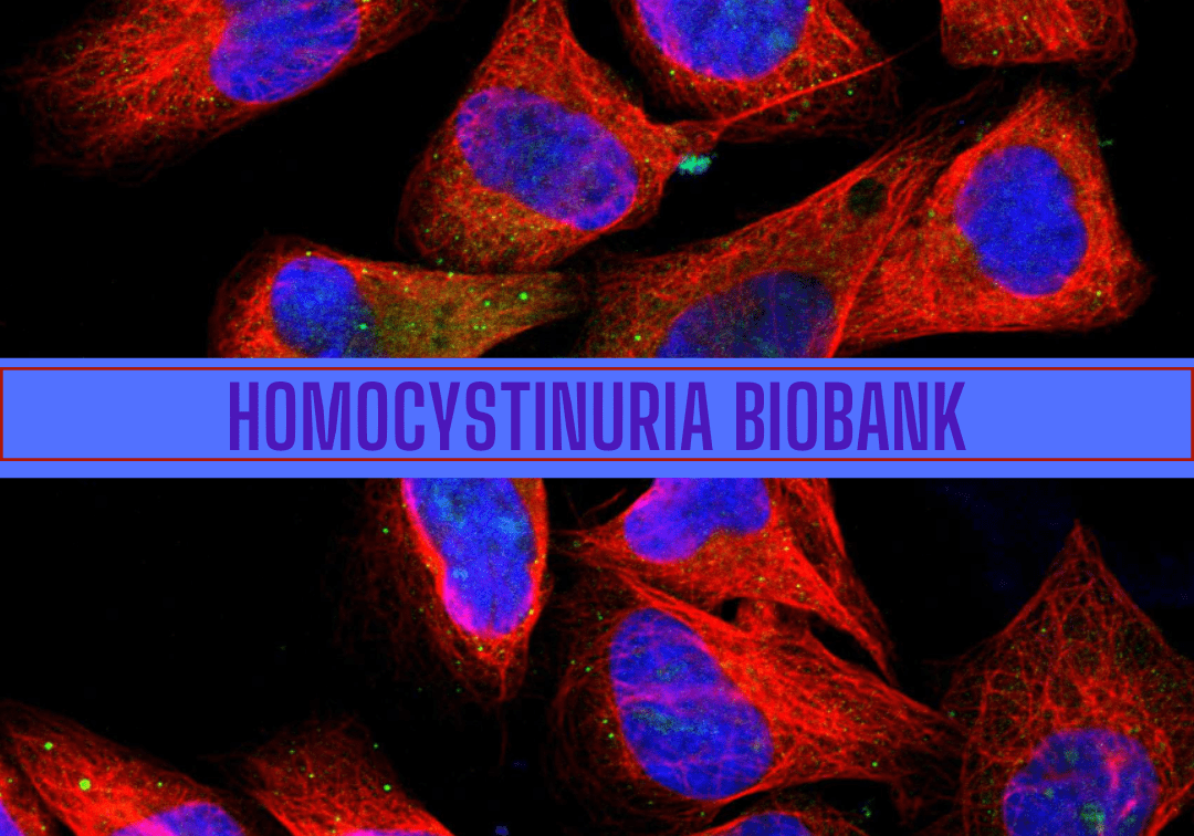 Homocystina biobank.